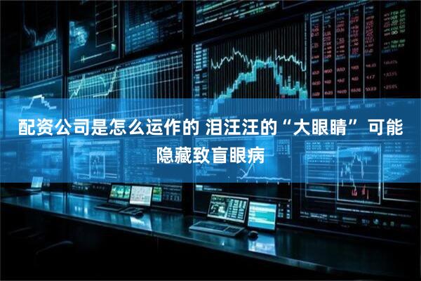 配资公司是怎么运作的 泪汪汪的“大眼睛” 可能隐藏致盲眼病